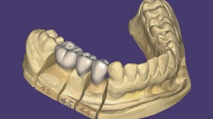 csm dentalcad overview c5aab530f6